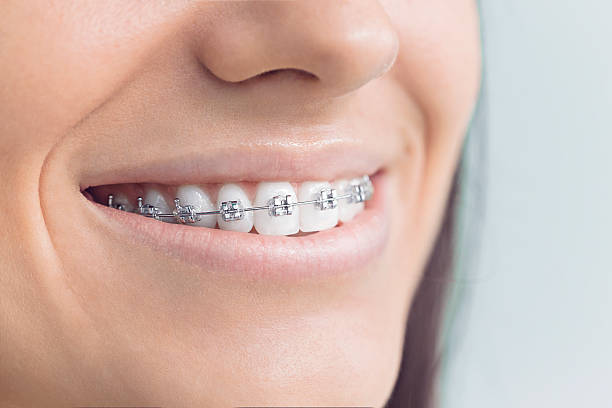 Best Veneers and Lumineers  in Pine Mountain Clu, CA